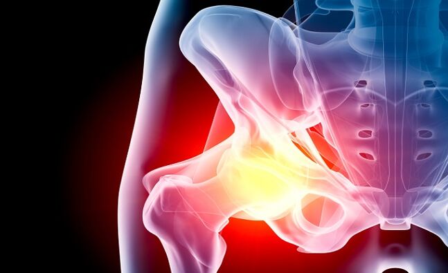 osteoarthritis of the hip joint