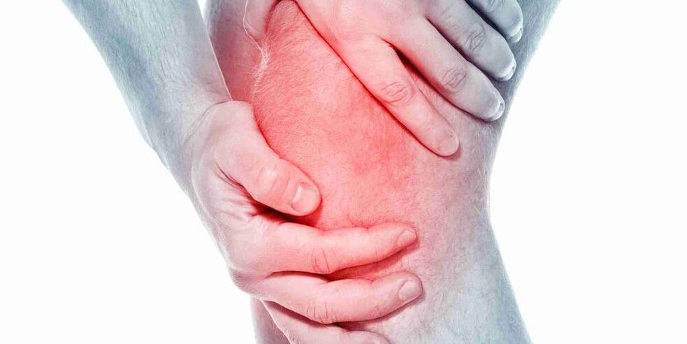 Pain in a folded or right knee is a symptom of osteoarthritis of the knee joint