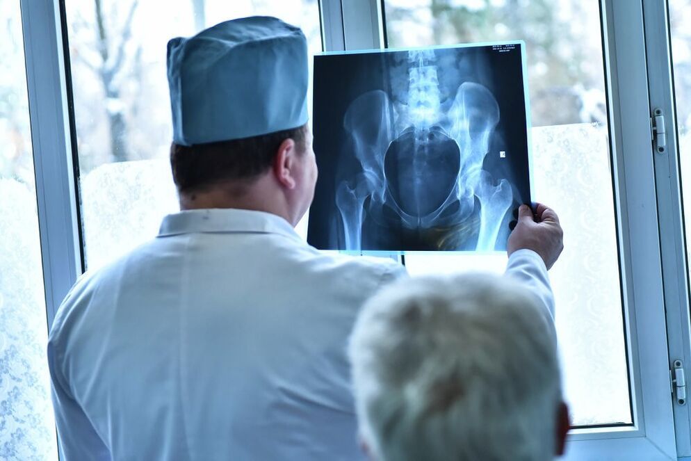 The doctor looks at a photo of a hip joint suffering from osteoarthritis